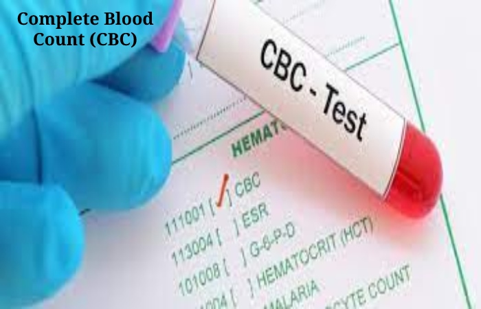 Bloodwork (4)