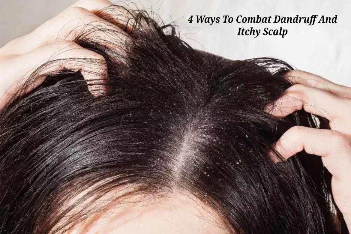 4 Ways To Combat Dandruff And Itchy Scalp