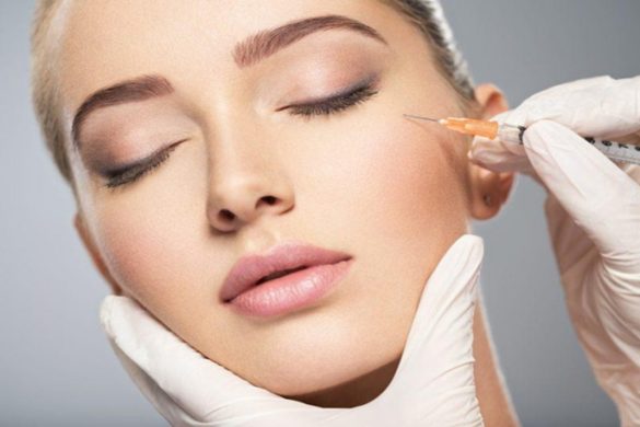 Botox - Anti-Wrinkle Injections
