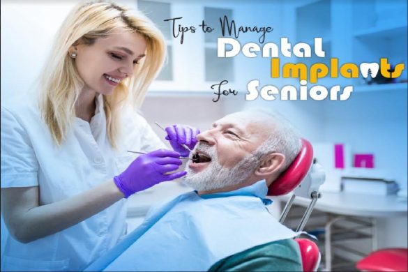 Tips to Manage Dental Implants for Seniors