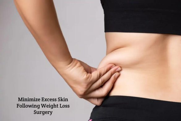 Minimize Excess Skin Following Weight Loss Surgery