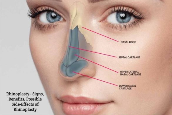 Rhinoplasty