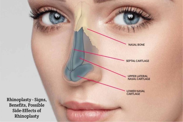 Rhinoplasty
