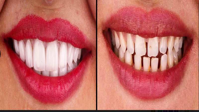 3 Things To Learn About Cosmetic Dentistry
