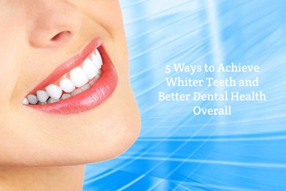 Achieve Whiter Teeth and Better Dental Health
