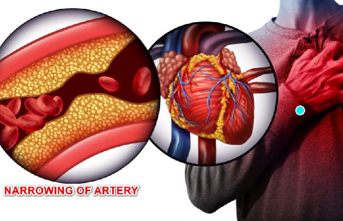 10 Different Common Causes of Chest Pain 