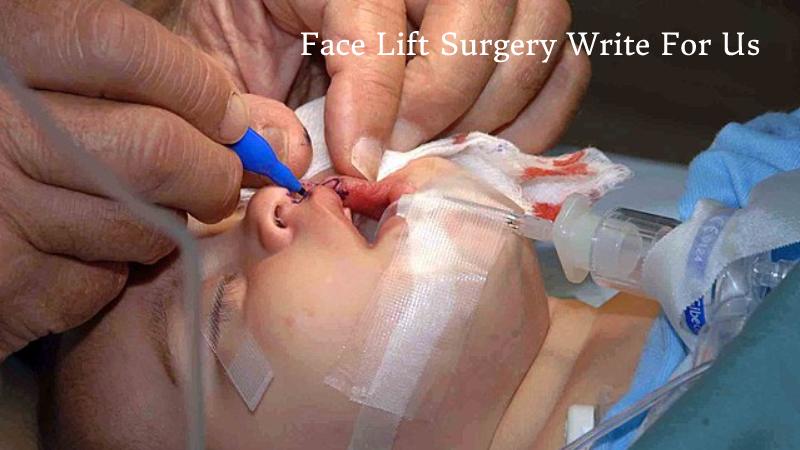 Face Lift Surgery Write For Us 