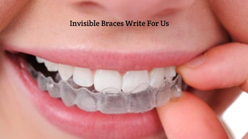 Invisible Braces Write For Us