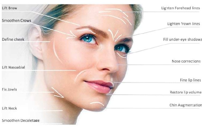 Non-surgical Facelifts