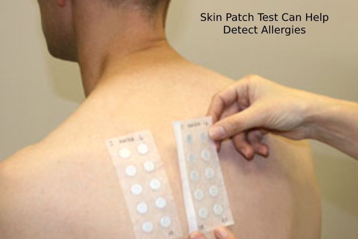 Skin Patch Test Can Help Detect Allergies Skin Patch Test Can Help Detect Allergies