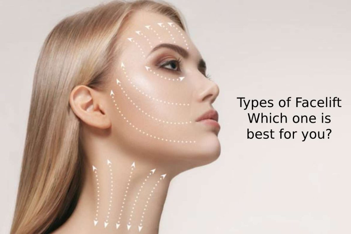 Types of Facelift _ Which one is best for you_