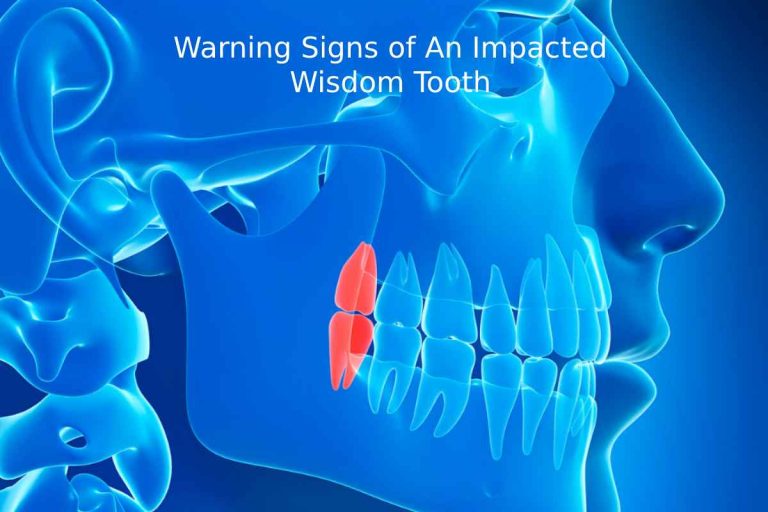 Warning Signs of An Impacted Wisdom Tooth