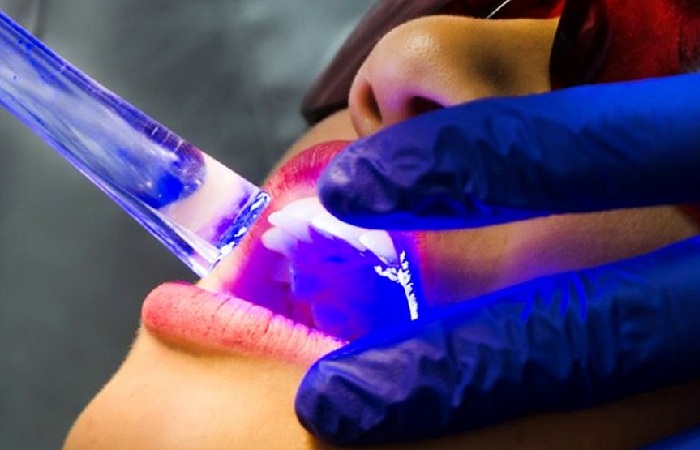 What Does A Cosmetic Dentist Do_ 