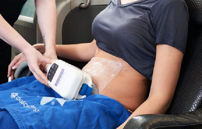 What To Expect During Your First Coolsculpting Session