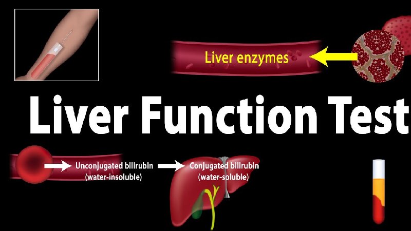 Liver Function Tests Write For Us 