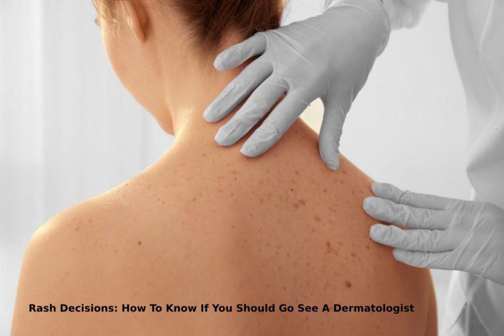 Rash Decisions: How To Know If You Should Go See A Dermatologist