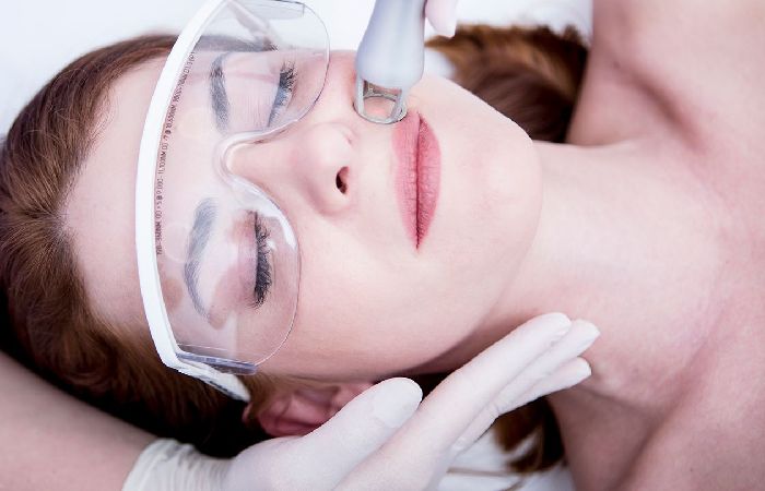 Best Time to Get Laser Resurfacing