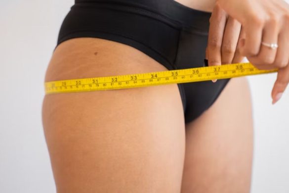Choosing the Right Liposuction Procedure