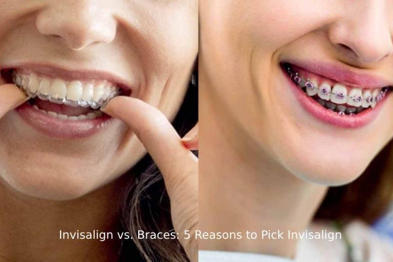 Invisalign vs. Braces_
