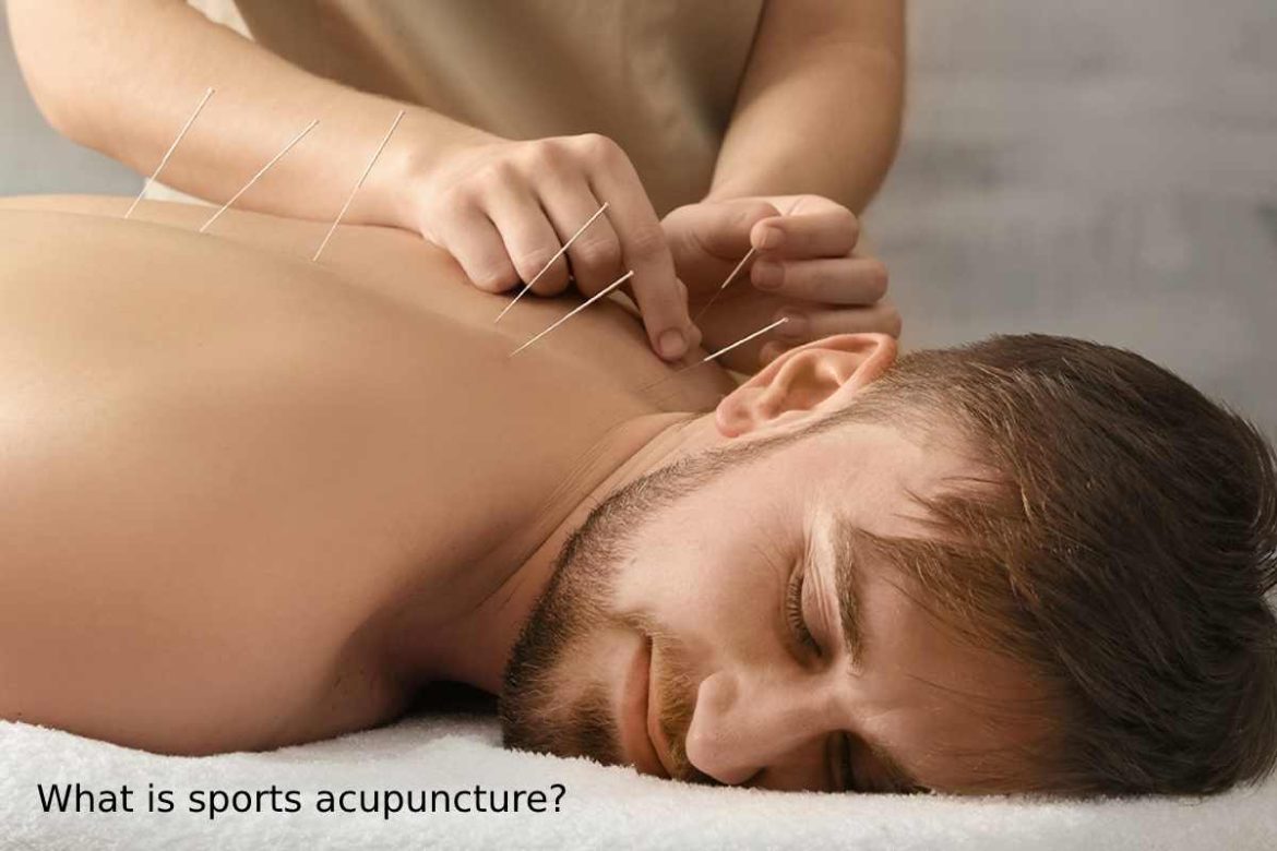 What is sports acupuncture_