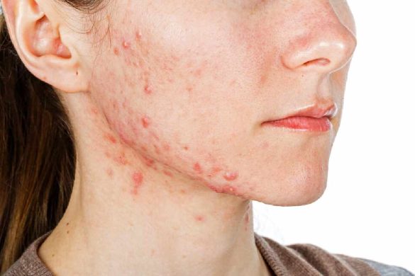 8 Skin conditions you should be aware of