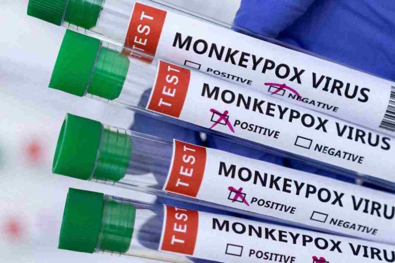 Monkeypox_ When to Get Tested and What to Do if Exposed