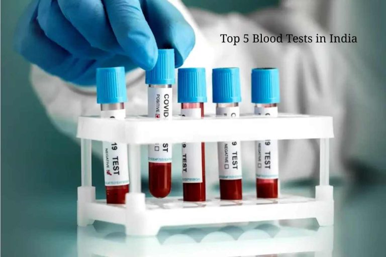 Top 5 Blood Tests in India