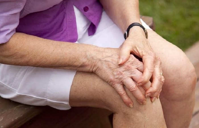 Arthritis