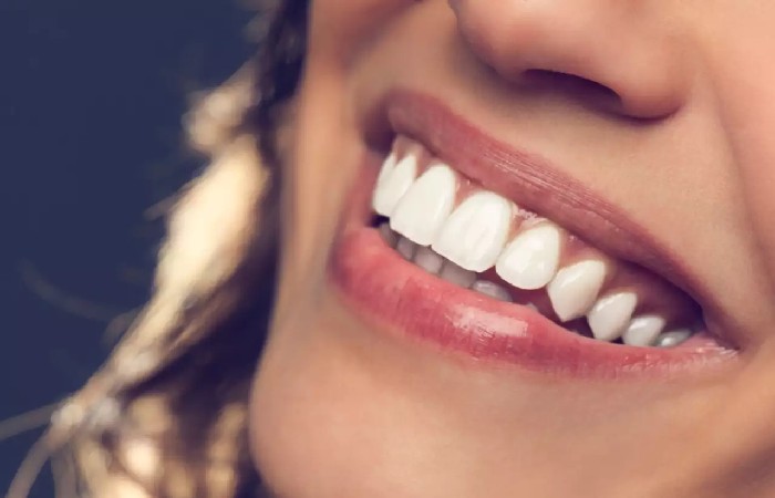 5 Ways to Achieve Whiter Teeth and Better Dental Health Overall