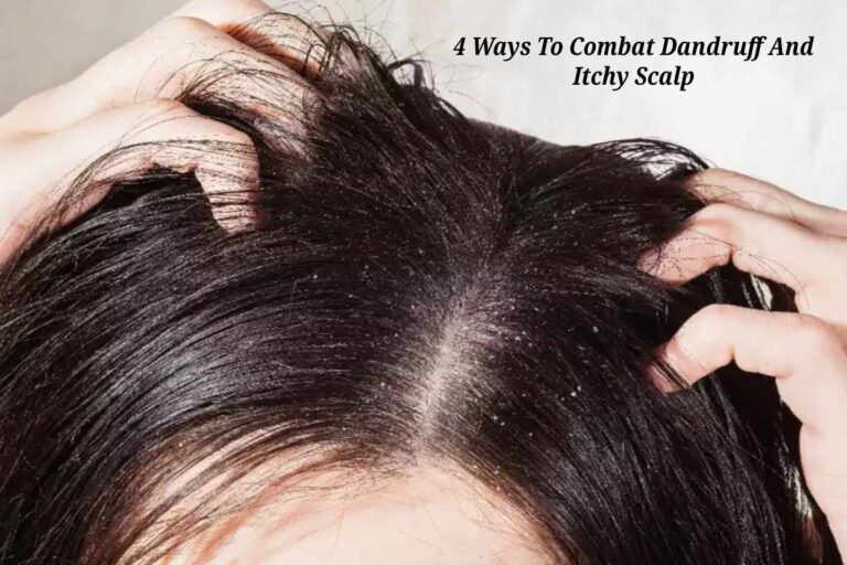 4-Ways-To-Combat-Dandruff-And-Itchy-Scalp-1