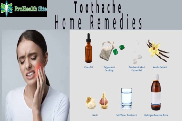 Home-Based-Remedies-for-a-Toothache