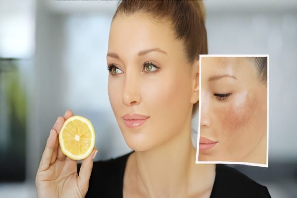 wellhealthorganic.com_lemon-juice-know-home-remedies-easily-remove-dark-spots (1)