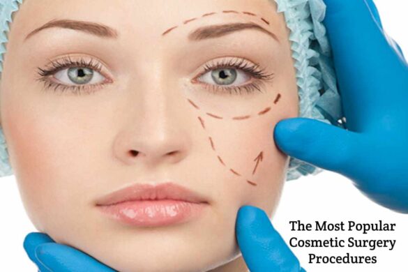 Cosmetic-Surgery-Procedures
