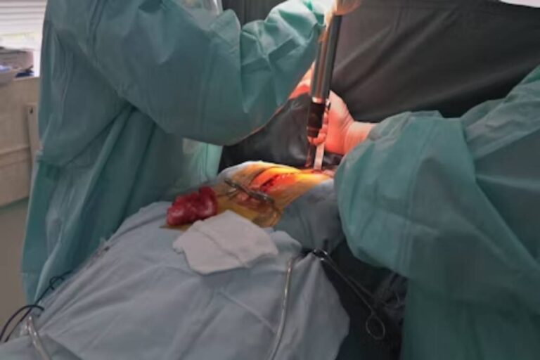 Bariatric-Surgery