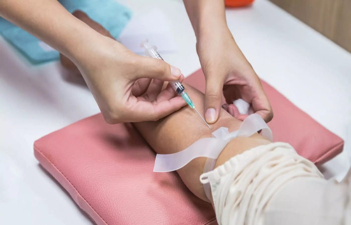 Liver Function Tests Write For Us