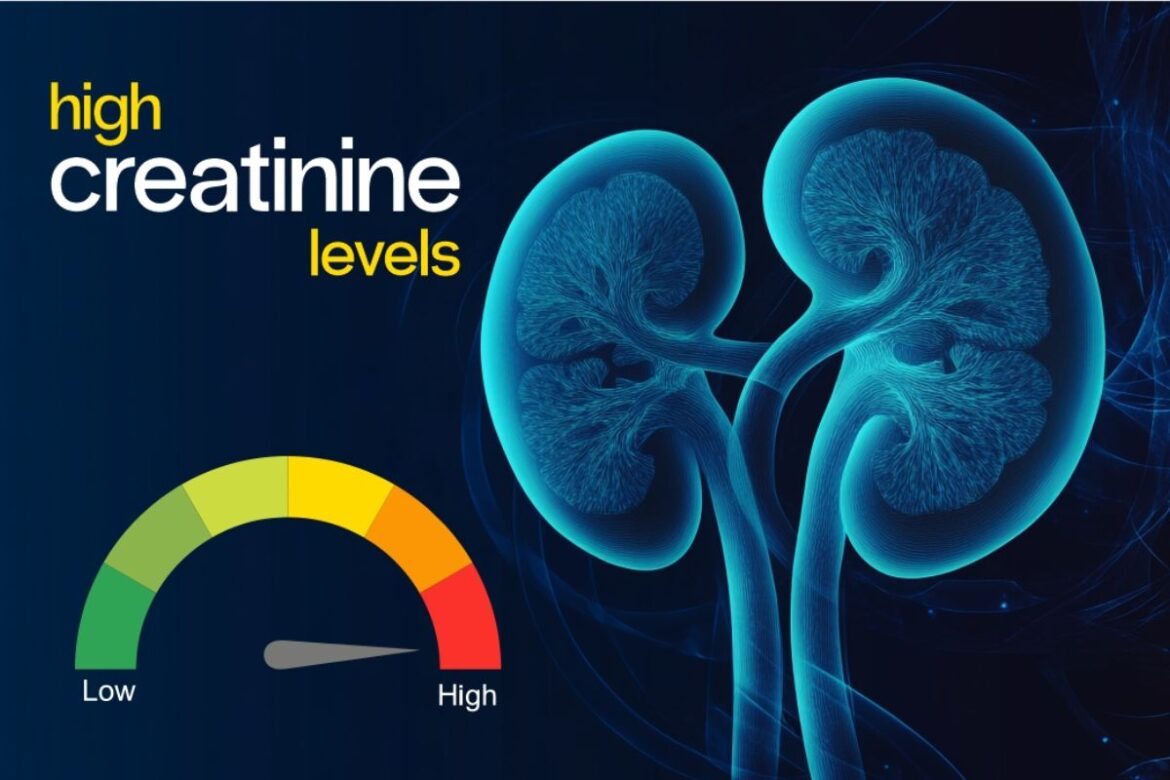 Creatinine High